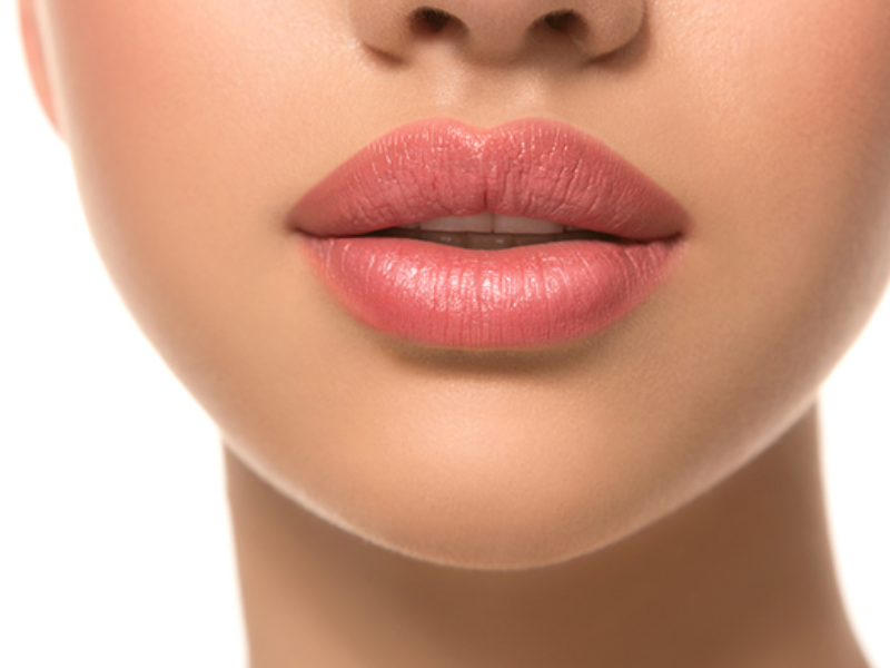 LIP FILLER