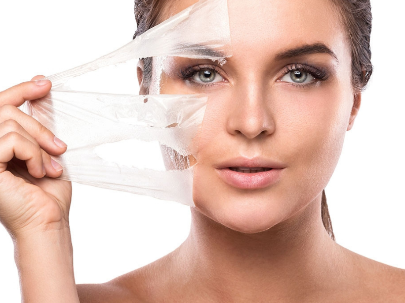 CHEMICAL PEELING