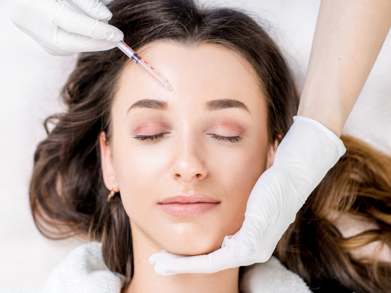 MIGRAINE BOTOX